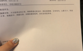 攀枝花找人代替抽血鸡西入职体检报告