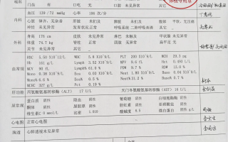 攀枝花找人代替抽血苏州工业园区入职体检